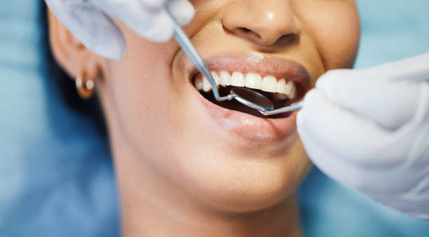 Best Emergency Dentist for Special Needs Patients in Frankston, TX
